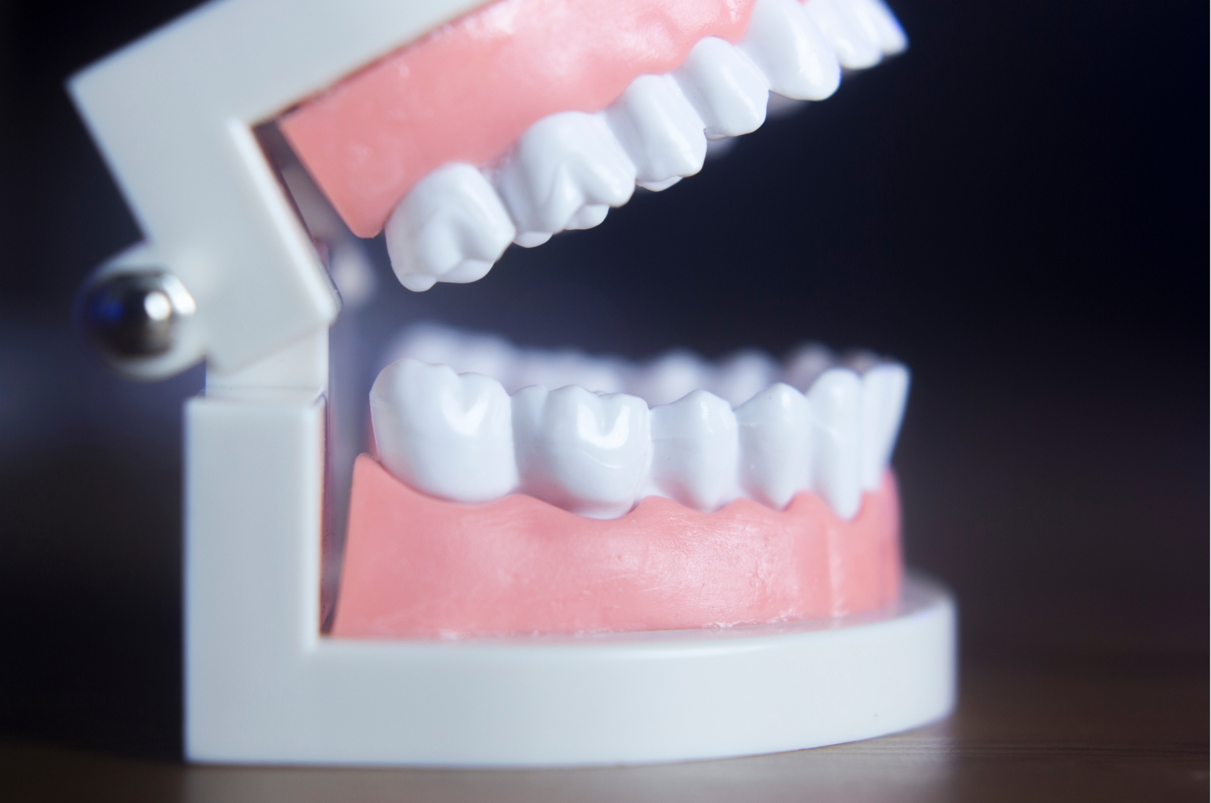 Bonding Vs  Veneers: What Matters Most In The Chair