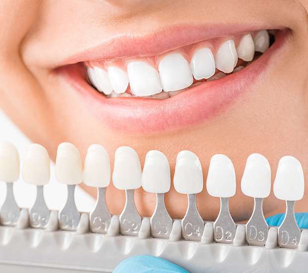 Sioux Falls Cosmetic Dentist
