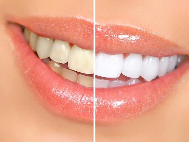 Dental Wellness