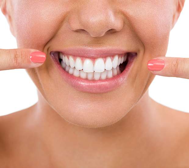 Sioux Falls What Is Gum Contouring and Reshaping