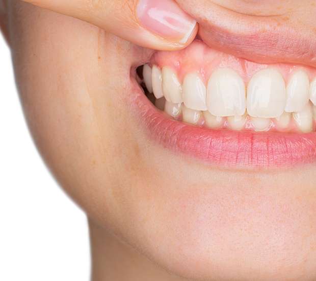 Sioux Falls Gum Disease