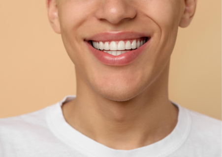 Close-up of a healthy smile with porcelain veneers designed to provide durable, natural-looking results for many years.