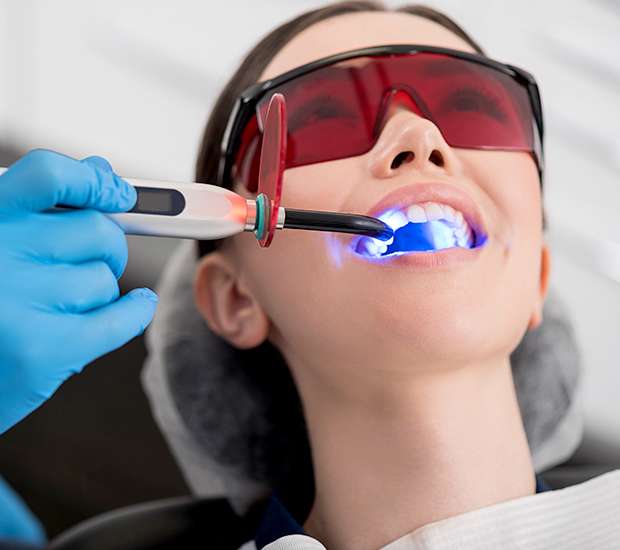 Sioux Falls Professional Teeth Whitening