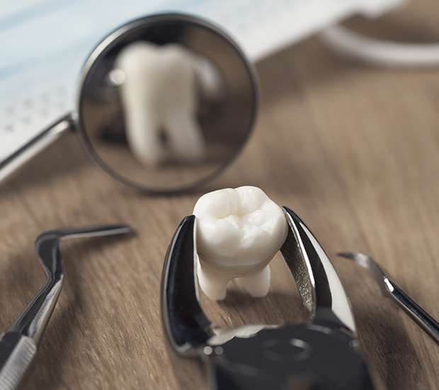 Sioux Falls When Is a Tooth Extraction Necessary